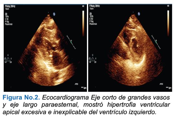 fig2