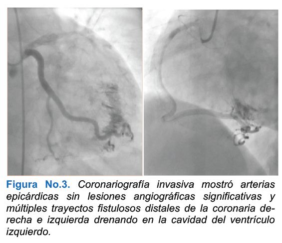 fig3